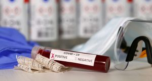 26-й узбекистанец скончался от COVID-19